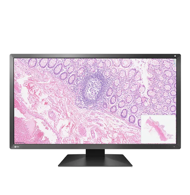 eizo-radiforce-px3150-cran-pathologie-num-rique-30-5-pouces-dci-4k-8mp image 1