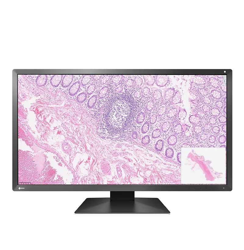 eizo-radiforce-px3150-cran-pathologie-num-rique-30-5-pouces-dci-4k-8mp image 1