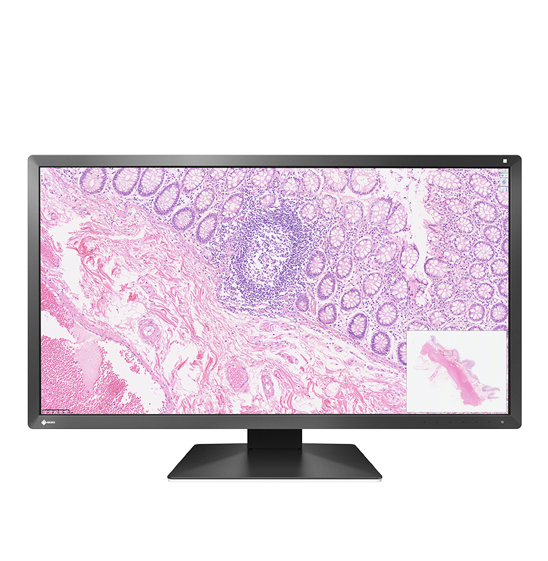 eizo-radiforce-px3150-cran-pathologie-num-rique-30-5-pouces-dci-4k-8mp image 1